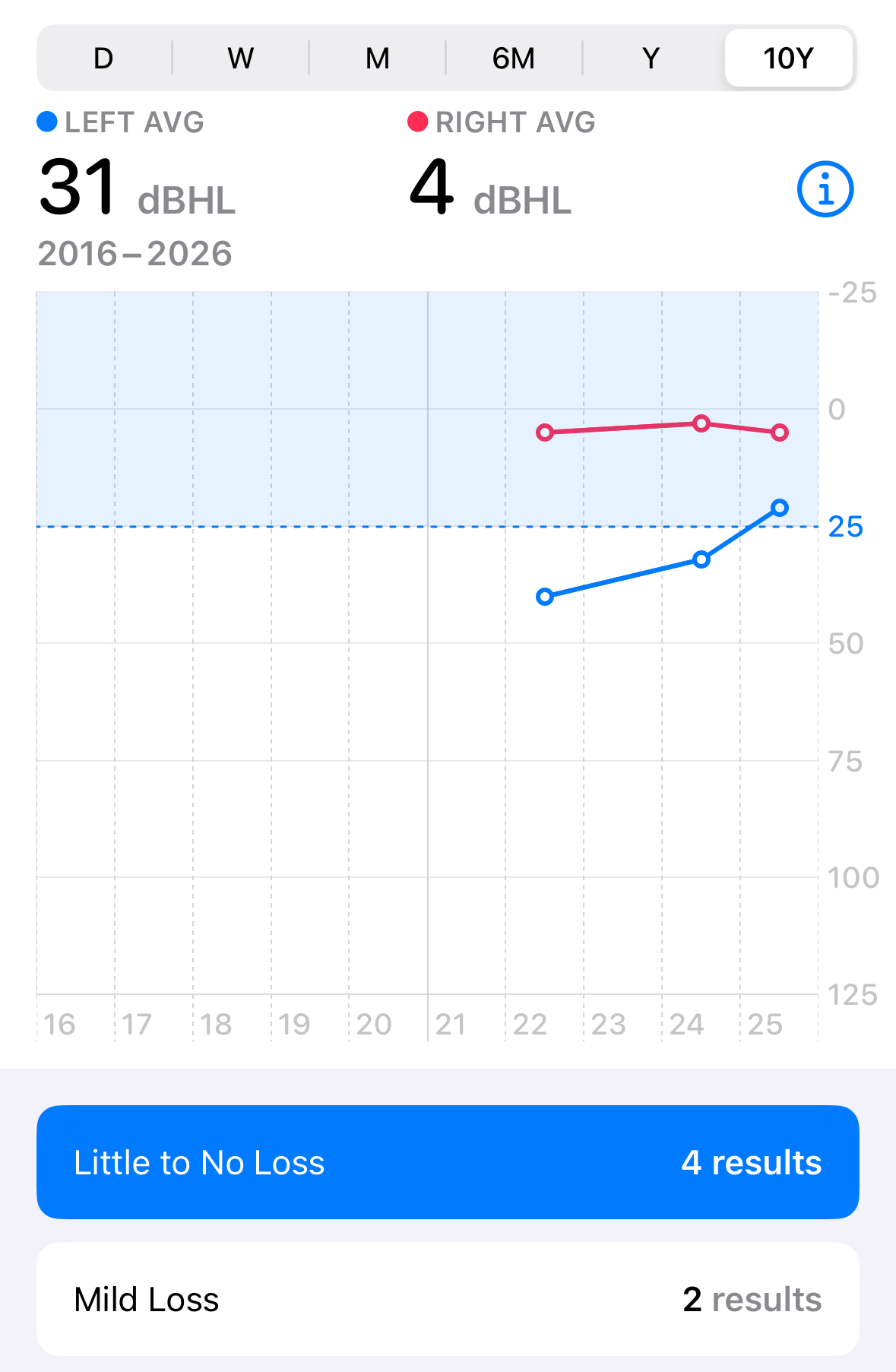 Trends in my hearing